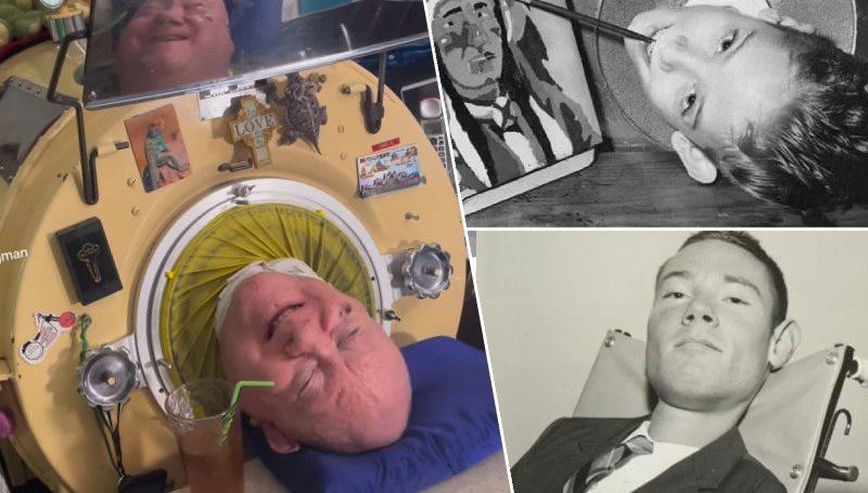 “Demir akciğer” içinde 72 yıl! 78 yaşında hayatını kaybetti