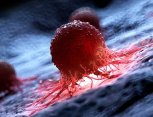 Bilim insanlarından yeni buluş: Kanserli hücrelerin yüzde 99’u yok edildi