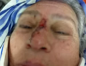 Boşanma Sonrası Şiddet Olayı