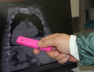 Dünyada bir ilk: Giresun Sendromu nedir, belirtileri nelerdir?