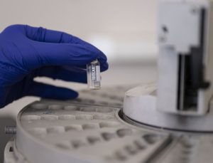 Gıda denetiminde bir ürünün içerisindeki binde 1’lik kusur bile tespit ediliyor