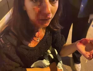 Konser Olayında Gençlik Kolları Başkanı Gözaltına Alındı