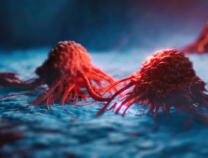 Meme kanseri 50 yaş altı kişilerde artışa geçti: Irklara göre ölüm oranı değişiyor!