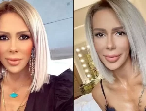Sosyetik güzel Hande Demir’in darp edildiği iddia edilmişti: İlk kez konuştu