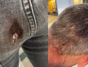 Ümraniye Belediyesi barınağını bastılar! Sözde hayvanseverler zabıtayı yaraladı