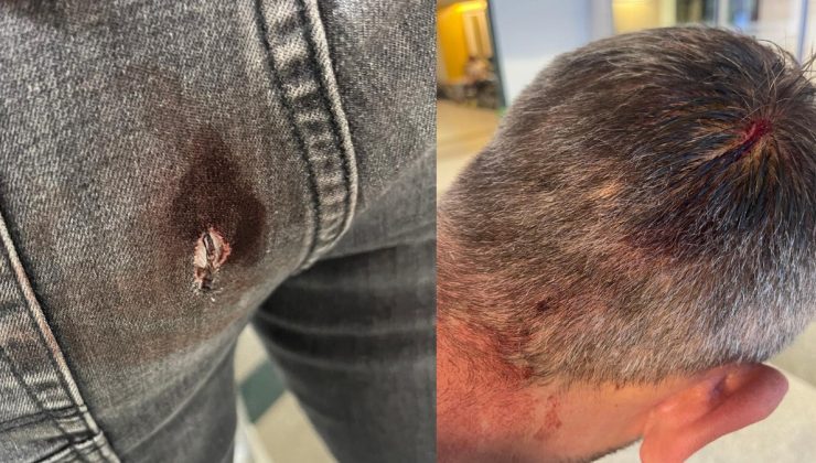 Ümraniye Belediyesi barınağını bastılar! Sözde hayvanseverler zabıtayı yaraladı