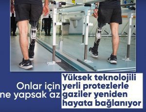 Üst düzey protezler, gazilerin yaşam standartlarını artırıyor