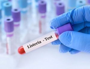 ABD’de “listeria” alarmı: Bir bebek öldü, 9 kişi hastaneye kaldırıldı