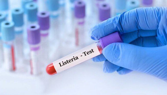 ABD’de “listeria” alarmı: Bir bebek öldü, 9 kişi hastaneye kaldırıldı