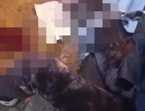 Ankara’da akademisyene köpek saldırısı: Ağır yaralandı