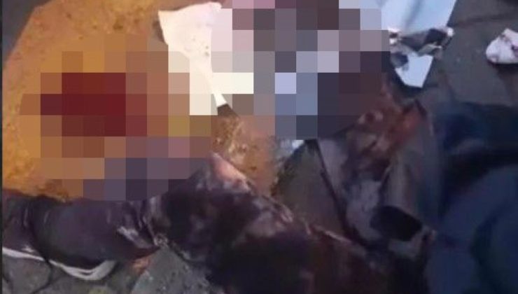 Ankara’da akademisyene köpek saldırısı: Ağır yaralandı