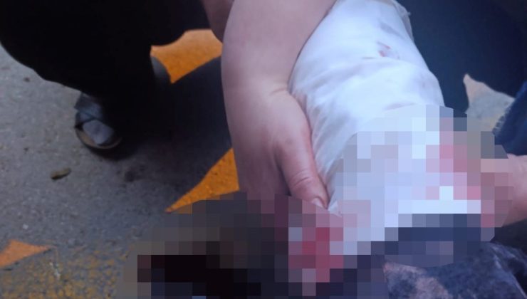 Ankara’da başıboş köpek dehşeti: Kadın akademisyenin bacakları ve yüzü parçalandı