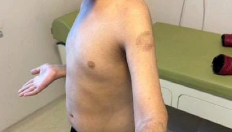 Beylikdüzü’nde özel bakım merkezinde otizmli çocuğa şiddet iddiası