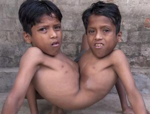 Dünyanın en ilginç hastalıkları