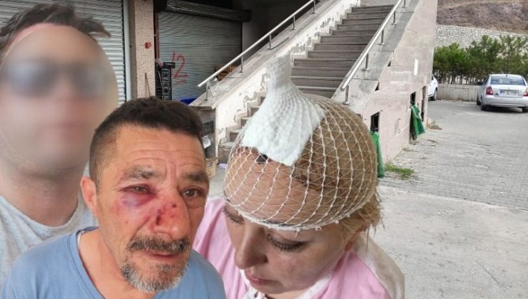 Ev sahibi ile kiracının zam kavgası: “Sopa üzerimde kırıldı, demir sopayla vurmaya devam etti!”