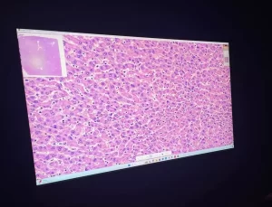 İTÜ’den Yapay Zeka ile Kanser Tespiti