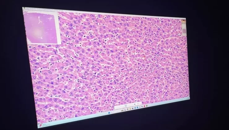 İTÜ’den Yapay Zeka ile Kanser Tespiti