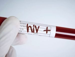 İzmir’de AIDS yüzünden ölen çocuğun babası HIV pozitif çıktı