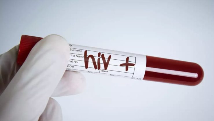 İzmir’de AIDS yüzünden ölen çocuğun babası HIV pozitif çıktı