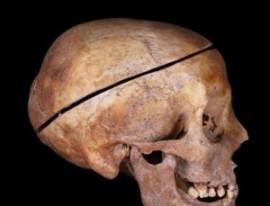 Ölü bedeni koruyan ilk yöntem: Aile boyu tahnitin 16. yüzyıldan kalan kalıntıları keşfedildi