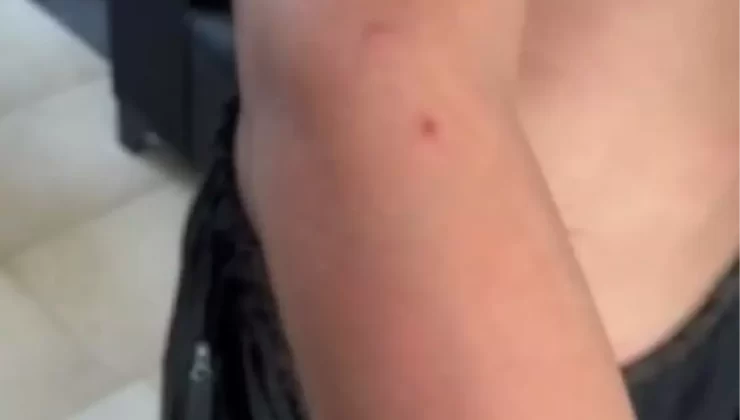 Özel Eğitim Kurumunda Şiddet İddiası: Aile Şikayetçi Oldu