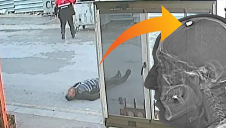 Silahla başından vuruldu, ölü taklidi yapıp kurtuldu!