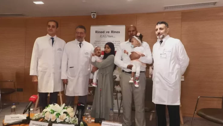 Yapışık İkizler Ameliyatla Ayrıldı