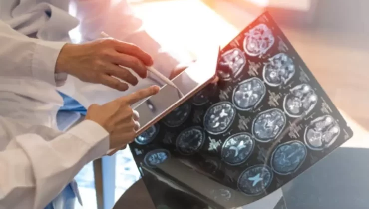 Yetersiz Uyku, Demans Riskini Artırıyor