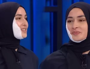 Yüzü yanan MasterChef Beyza sargısını çıkardı, akıllara kurgu şüphesi geldi