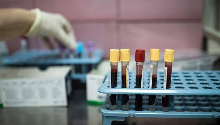 Zenginlerin ölümsüzlük iksiri olarak biliniyor! Çocuklardan üretildiği iddia edilen “Adrenokrom” hakkında bilinenler