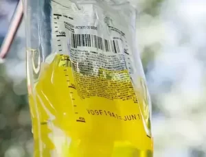 Uzmanından sarı serum açıklaması