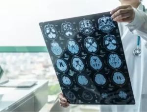 Bunamanın Erken Belirtileri Vücut Değişiklikleriyle Ortaya Çıkıyor