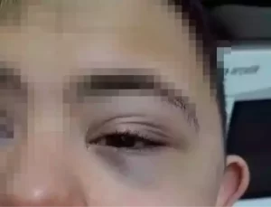 Down Sendromlu Öğrenciye Şiddet Uygulayan Öğretmene Para Cezası