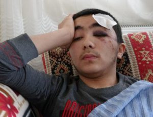 Isparta’da başıboş köpeklerden kaçan çocuk mevtten döndü