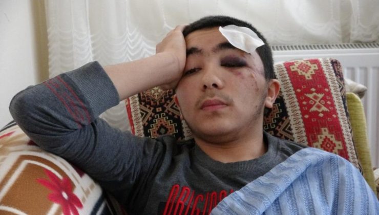 Isparta’da başıboş köpeklerden kaçan çocuk mevtten döndü