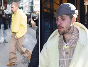 Justin Bieber’ın son hali hayranlarını endişelendirdi