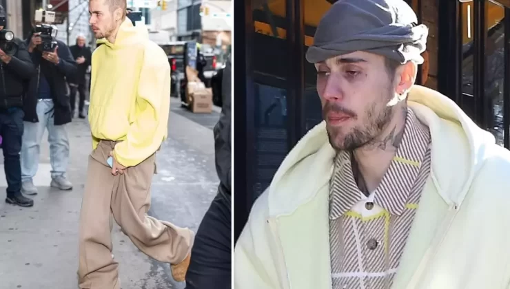 Justin Bieber’ın son hali hayranlarını endişelendirdi