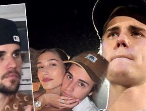 Justin Bieber’ın yüzündeki değişim hayranlarını endişelendirdi