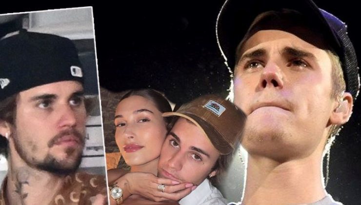 Justin Bieber’ın yüzündeki değişim hayranlarını endişelendirdi