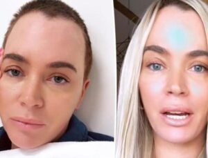 Ünlü oyuncu defalarca ameliyat oldu, bir türlü iyileşemedi… Kanser akciğerine sıçradı… Üç çocuğu için umutla savaşıyor